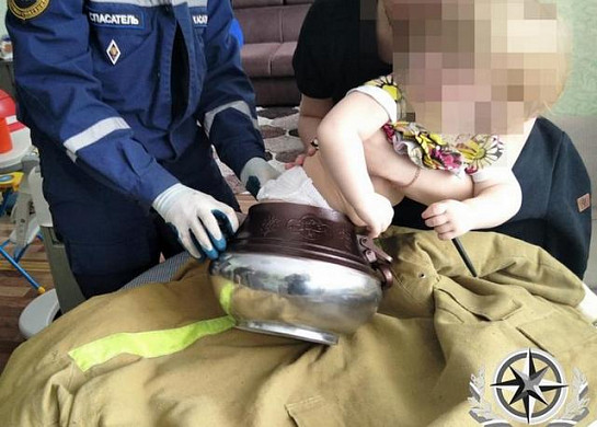 В Иванове ребенок застрял в казане